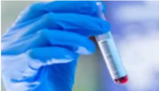 ملک میں کورونا انفیکشن کے فعال کیسز کی تعداد  تقریباً سات ہزار