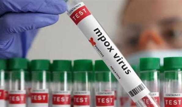 Angola reports 1st Mpox case: Ministry