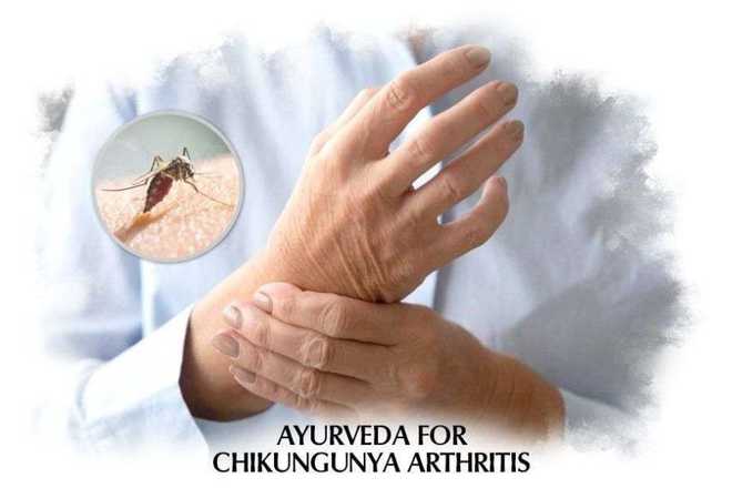 Chikungunya Arthritis: Follow these tips to Recover from Chikungunya Arthritis Naturally