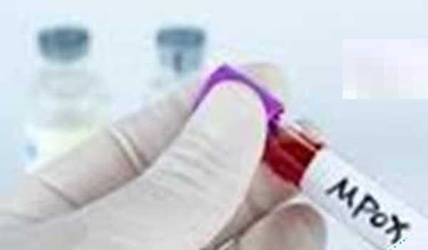 Zambia confirms first mpox death as infections rises to 31