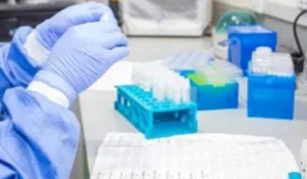 Toll of Lassa fever outbreak in Nigeria rises to 127