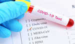257 active COVID cases in India so far, situation under control : DGHS